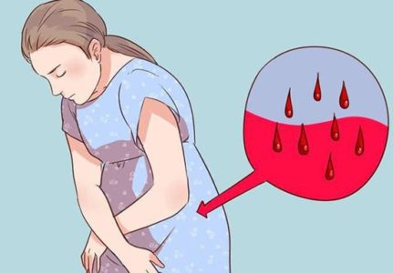 кровянистые выделения во время беременности