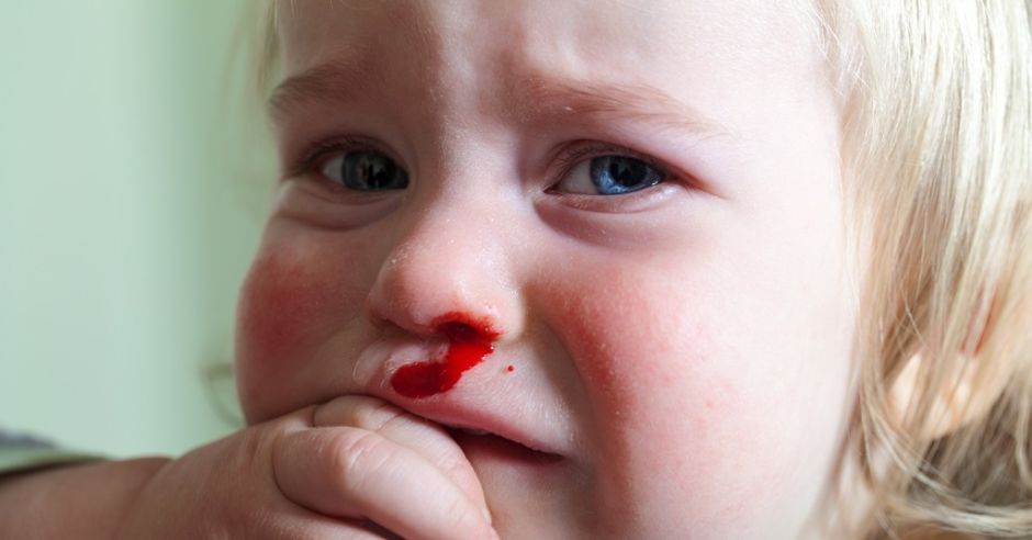 у ребенка кровь из носа