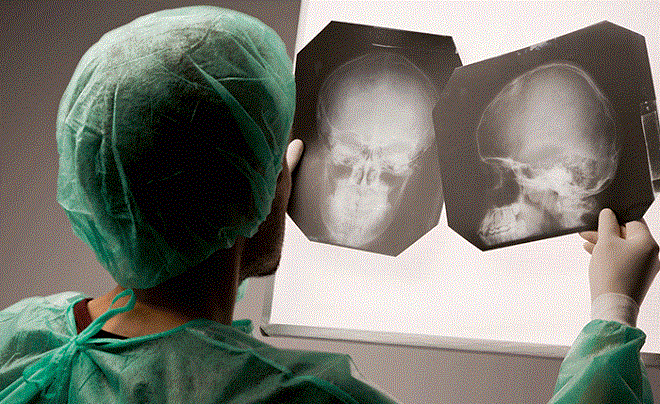 рентген головы после травмы