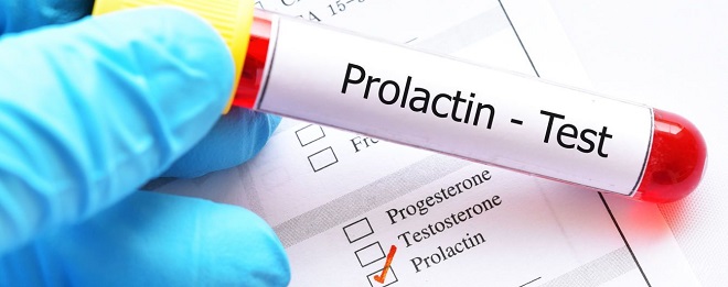 тест на пролактин