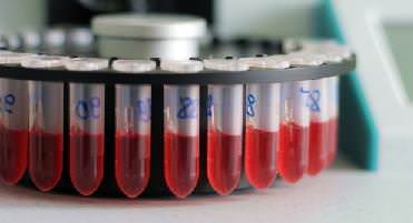 общий анализ крови расшифровка