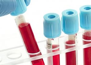 лейкоциты в крови понижены