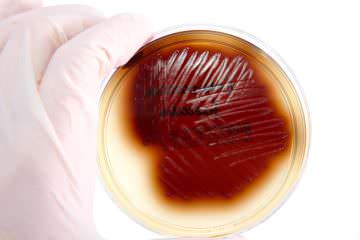 Причины появления бактериемии, ее диагностика и лечение
