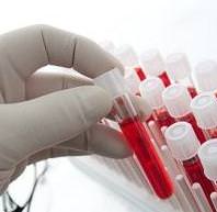 как проводят биохимический анализ крови