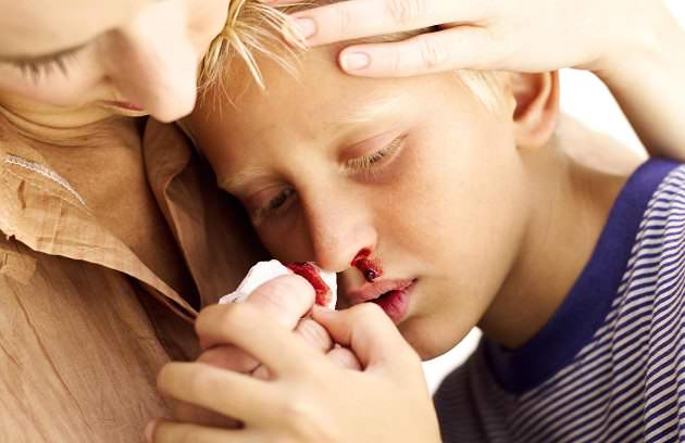 Носовое кровотечение у ребенка