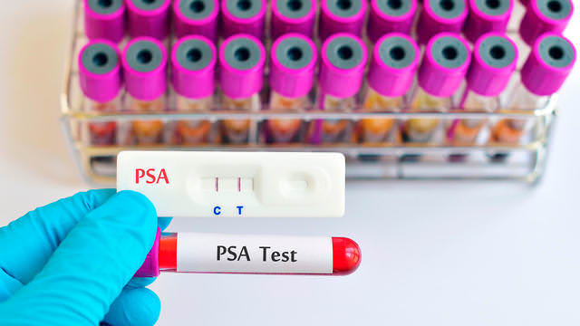 Что такое анализ крови ПСА?