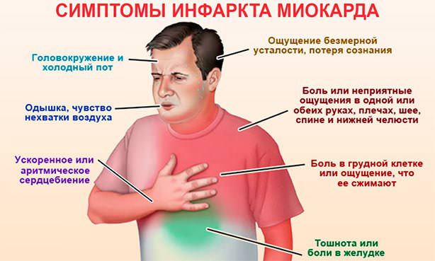 Симптомы, по которым можно распознать инфаркт
