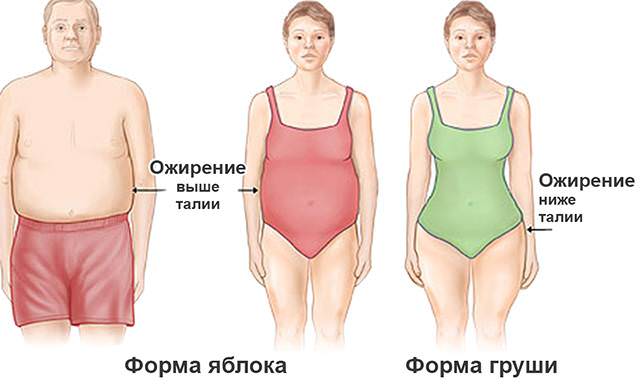 Ожирение у мужчин и женщин