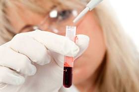 Повышенные лейкоциты в крови причины