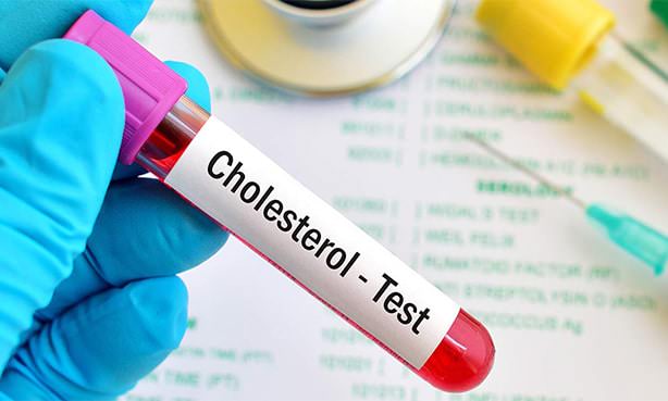 Тест на холестерин: индекс атерогенности