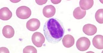 Почему лимфоциты в крови понижены, о чем это говорит?