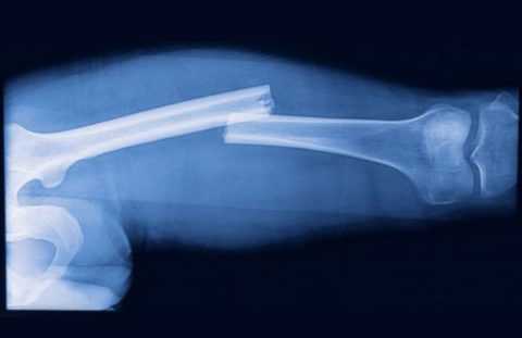 Процесс срастания кости должен контролироваться на рентгенограмме.